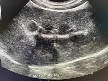 ultrasound